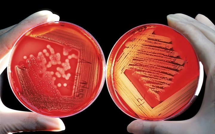 MRSA – Wie schützt man sich vor multiresistenten Krankheitserregern?